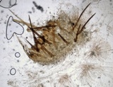 Scutellinia crinita image