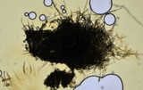 Lasiosphaeris hirsuta image