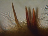 Pseudochaete tabacina image