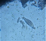 Mycoporum antecellens image