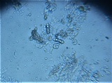 Mycoporum antecellens image