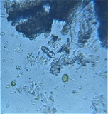 Mycoporum antecellens image