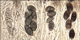 Rinodina oleae image