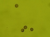Reticularia lycoperdon image