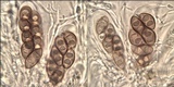 Rinodina oleae image