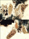 Opegrapha physciaria image