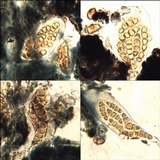 Opegrapha physciaria image