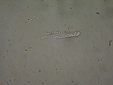 Neodasyscypha cerina image
