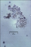 Cosmospora coccinea image