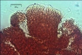 Cosmospora coccinea image