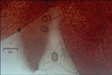 Cosmospora coccinea image