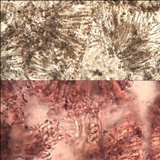 Protoblastenia calva image