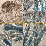 Protoblastenia calva image