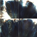 Lecania spadicea image