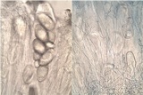 Ochrolechia parella image