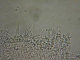 Sistotrema brinkmannii image