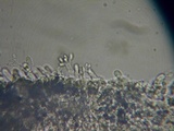 Sistotrema brinkmannii image