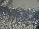 Sistotrema brinkmannii image