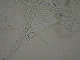Sistotrema brinkmannii image
