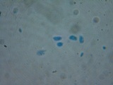 Sistotrema brinkmannii image