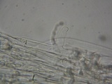 Nolanea holoconiota image
