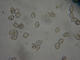 Nolanea holoconiota image