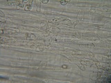 Nolanea holoconiota image