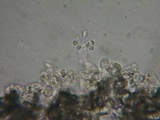 Botryobasidium obtusisporum image
