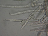 Botryobasidium obtusisporum image