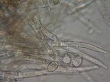 Botryobasidium obtusisporum image
