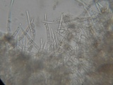 Botryobasidium obtusisporum image