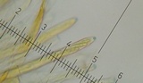 Arachnopeziza aurelia image