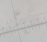 Arachnopeziza aurelia image