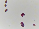Psathyrella bipellis image