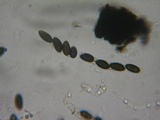 Biscogniauxia nummularia image