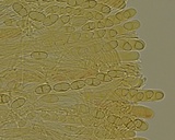 Tarzetta cupularis image