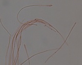 Tarzetta cupularis image