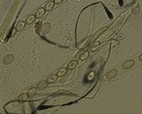 Scutellinia crinita image