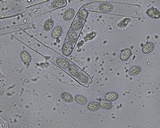 Scutellinia crinita image