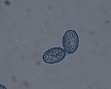 Scutellinia crinita image