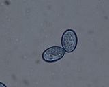 Scutellinia crinita image