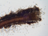 Melanospora lagenaria image
