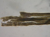 Melanospora lagenaria image