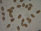 Melanospora lagenaria image