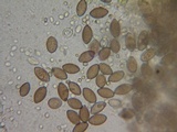 Melanospora lagenaria image