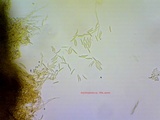 Arachnopeziza aurelia image