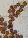 Scleroderma areolatum image