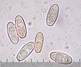 Sarcosphaera coronaria image