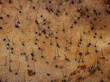 Melanospora lagenaria image