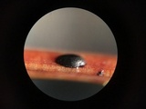 Lophodermium pinastri image